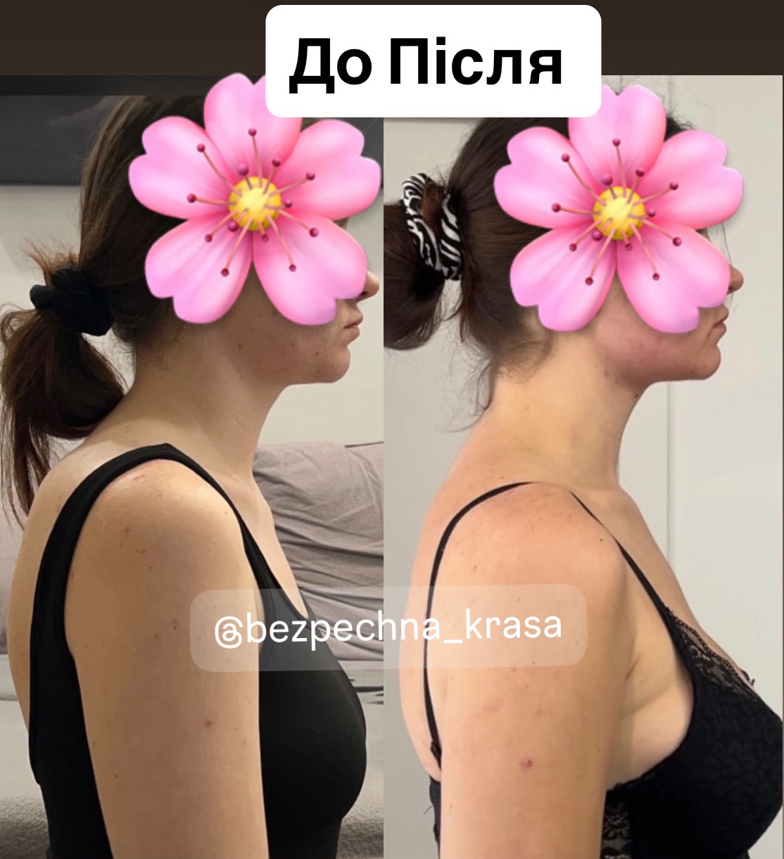 Як може шия і постава змінитися за два місяці