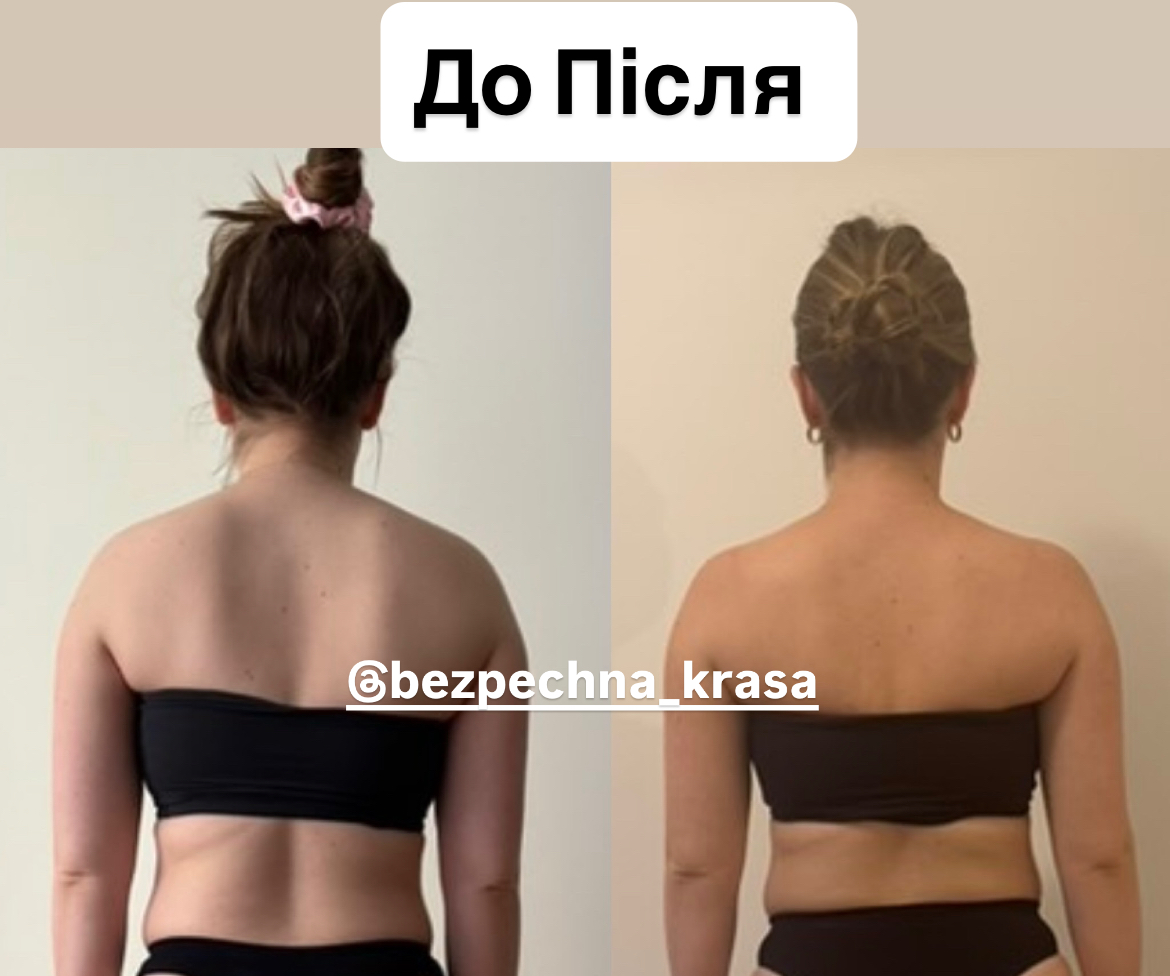 Як можна красиво вирівняти поставу