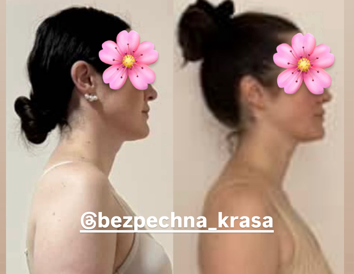 Зробити шию довшою, прибрати сутулість, виправити поставу