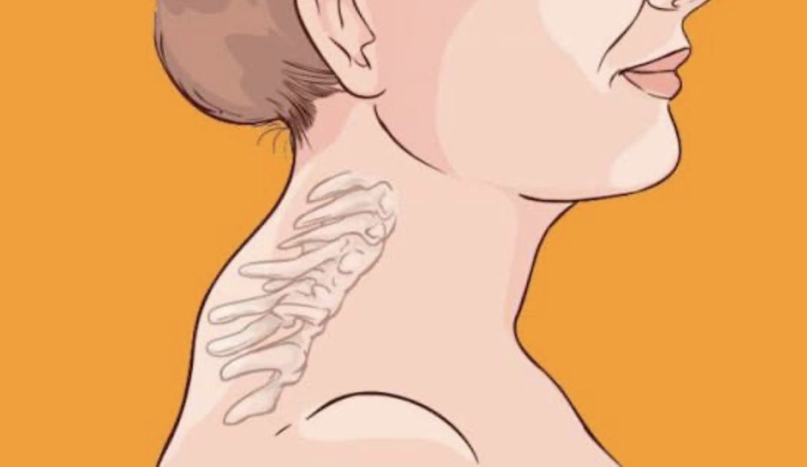 Холка. Причини і що робити